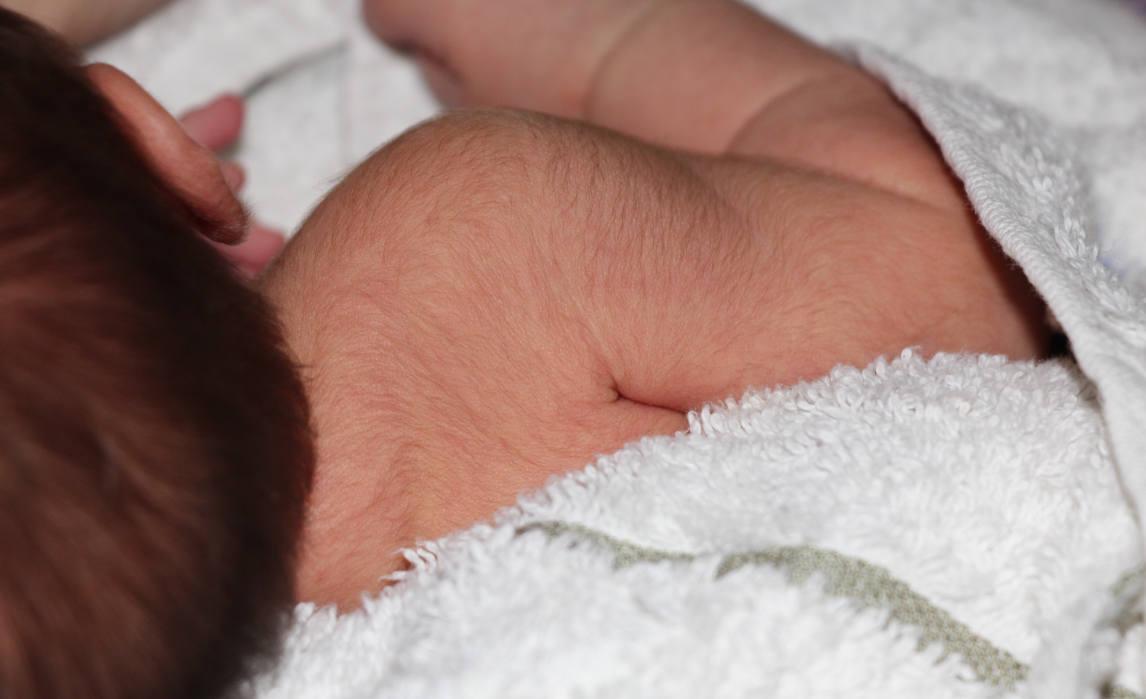 Bayi baru lahir memiliki banyak rambut di seluruh tubuhnya