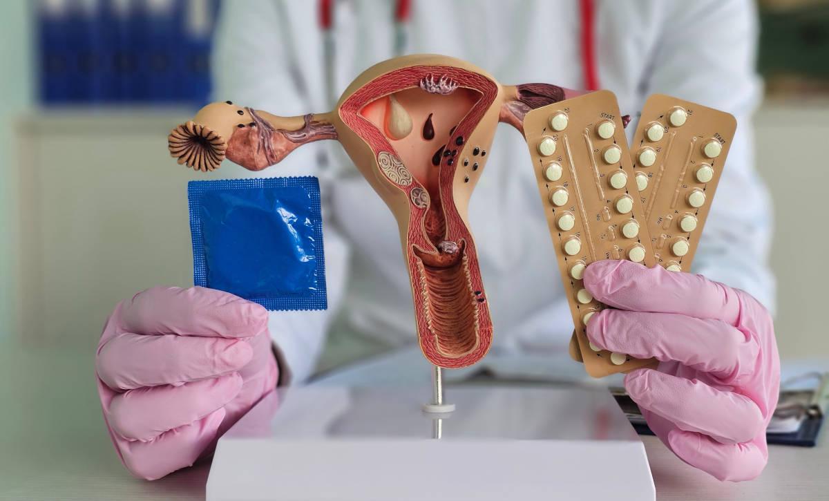 Berbagai pilihan metode kontrasepsi