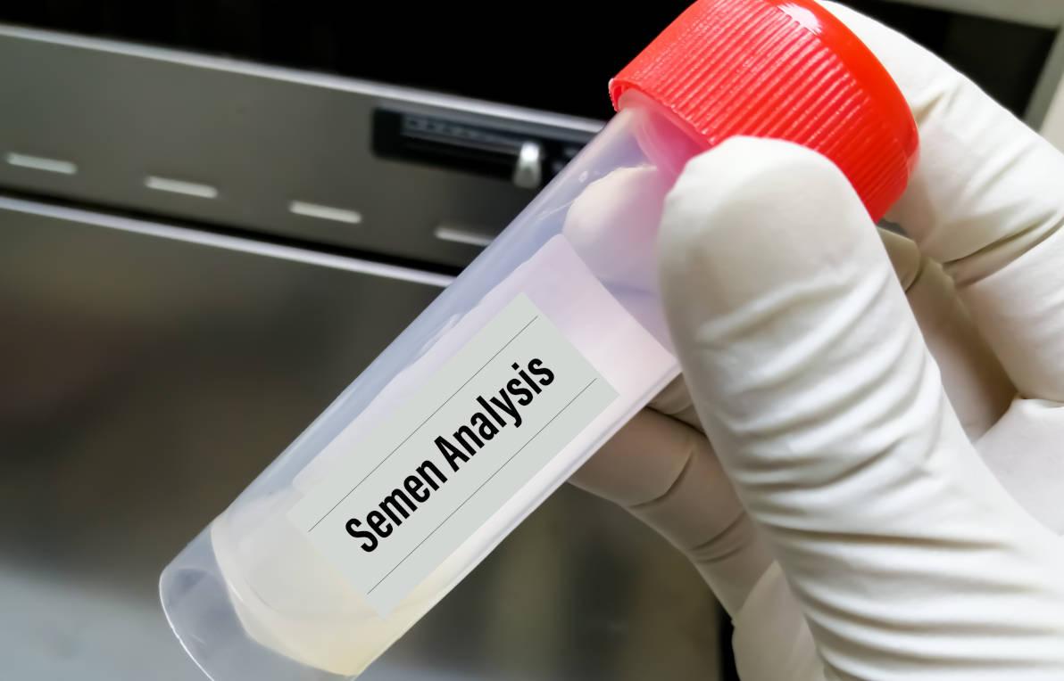 Analisis cairan semen untuk mendeteksi kelainan pada sperma