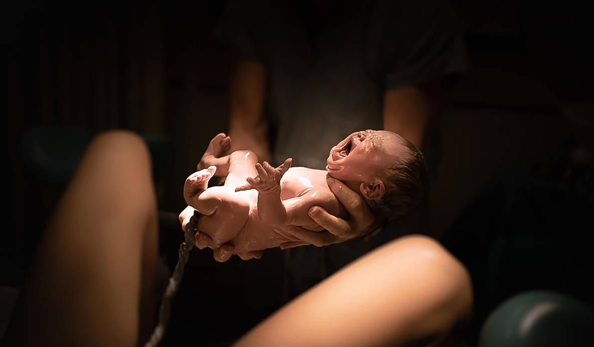 Bayi baru saja dilahirkan melalui persalinan normal