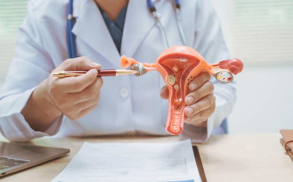 Dokter sedang menunjukkan penyakit kista rahim