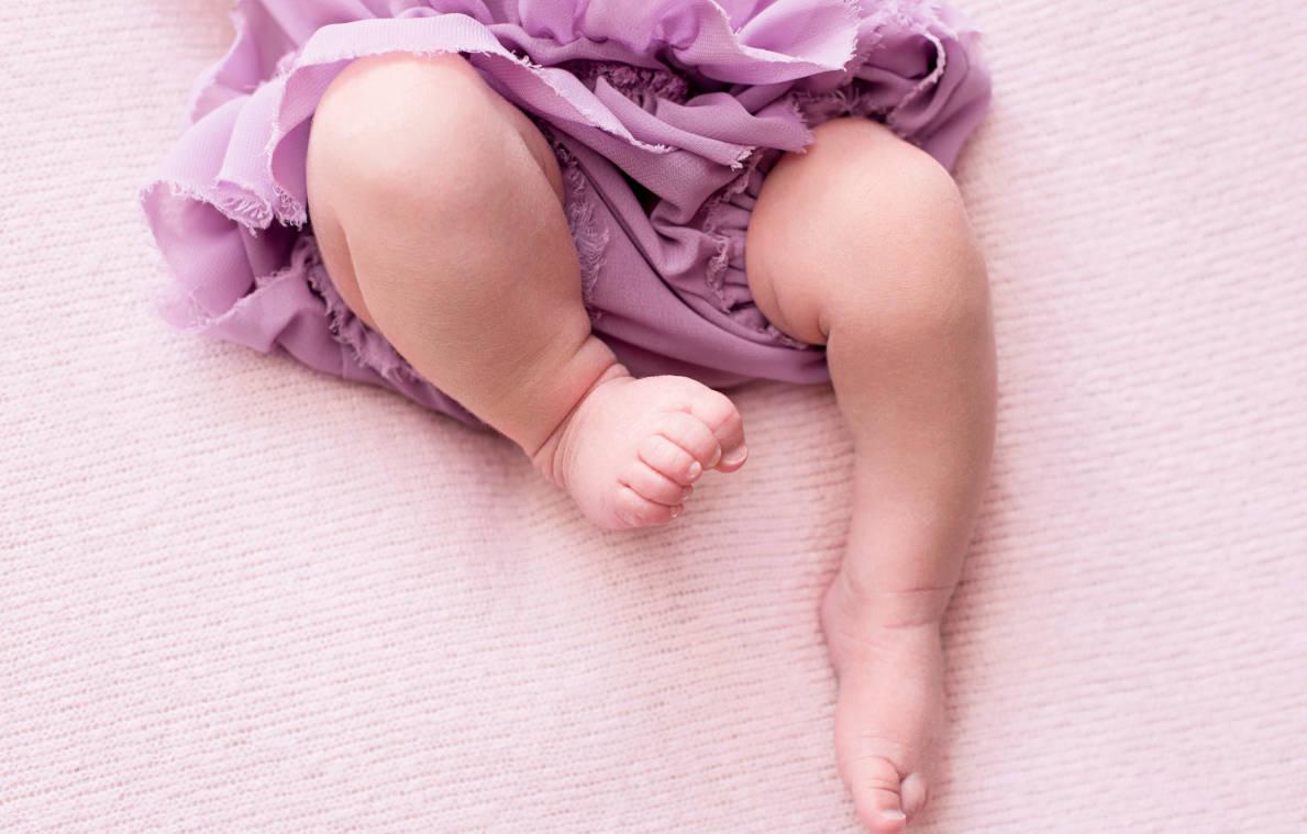Bayi dengan kaki melengkung biasanya hal normal