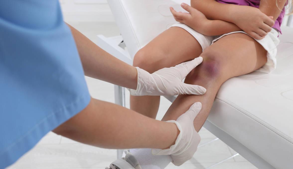 Dokter sedang memerika lutut anak yang memar