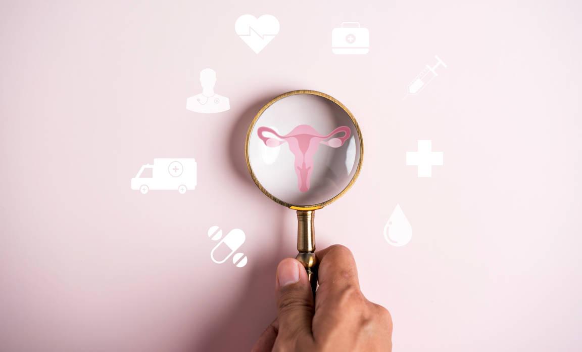 Organ reproduksi wanita