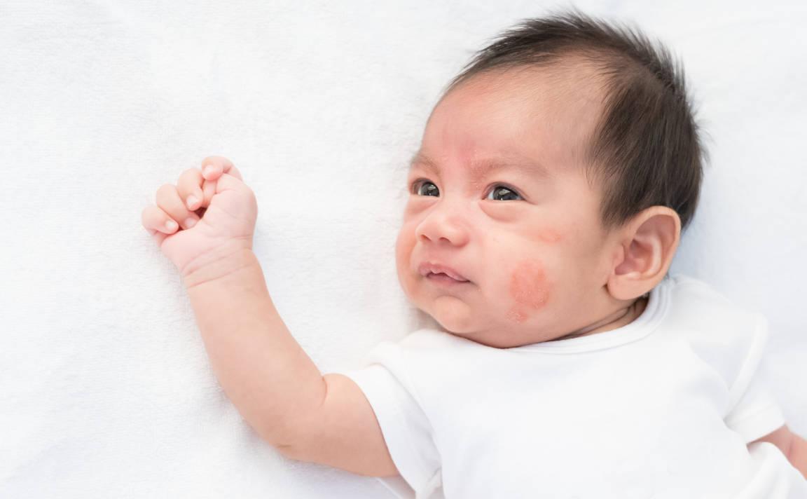 Kulit bayi nampak merah
